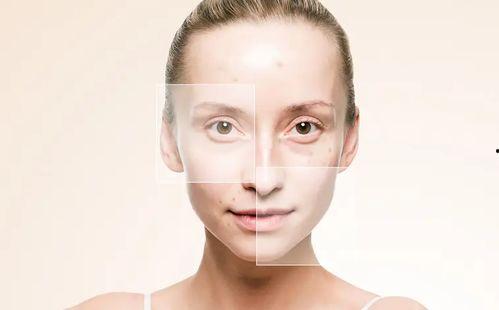 国产痘痘肌修复视频